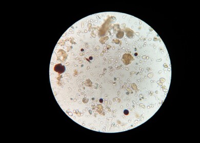 Pluton Biosciences received financing to find the new uses for microbes in agriculture