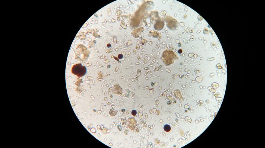 Pluton Biosciences received financing to find the new uses for microbes in agriculture